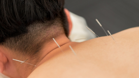 The Bisoma Acupuncture Approach to Sports Injuries