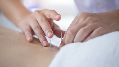 Acupuncture Protocols for Treating the Hip