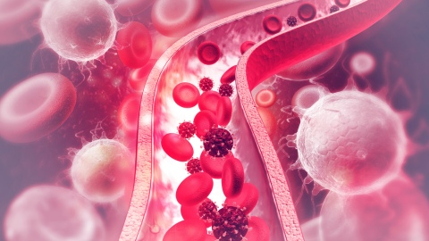 A Review of Arterial Blood Gas Interpretation for Physiotherapists