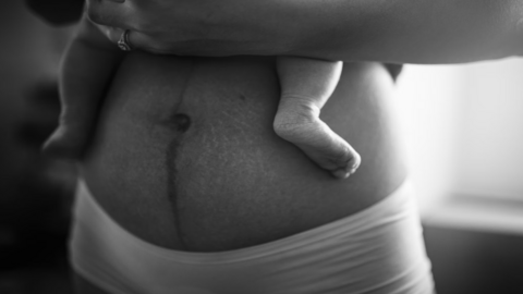 Postpartum Pelvic Health