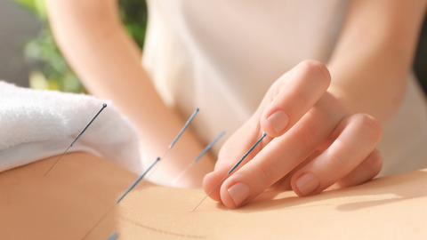 Western Medical Acupuncture (WMA)
