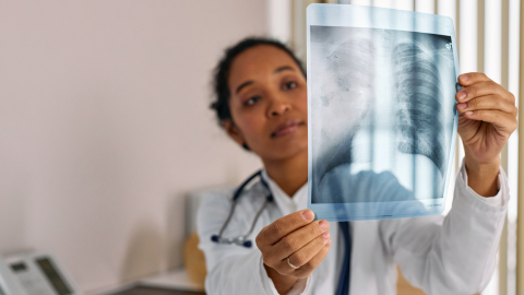 Physiotherapy Management of MRSA Pneumonia Sepsis in the ICU