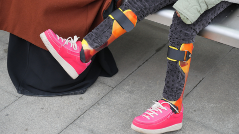 PED: Assessment of Complex Gait and Motor Patterning in Pediatrics 