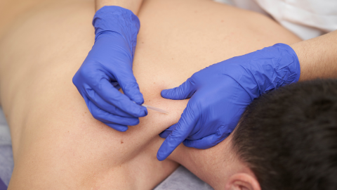 ADN: Neurofunctional Electroacupuncture: Science-based secrets to the treatment of "Pain with Movement" disorders