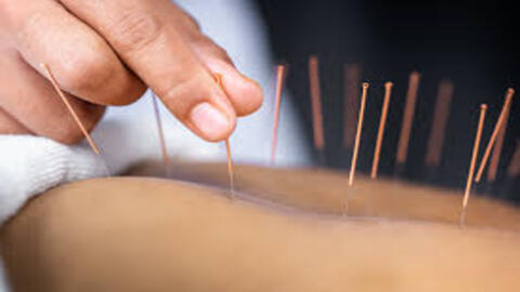 ADN: Western Medical Acupuncture (WMA)
